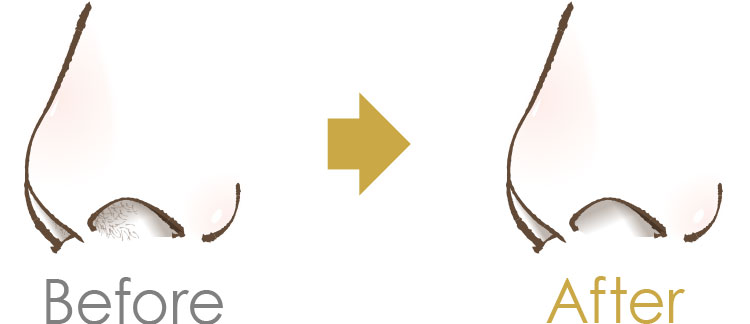 Before After